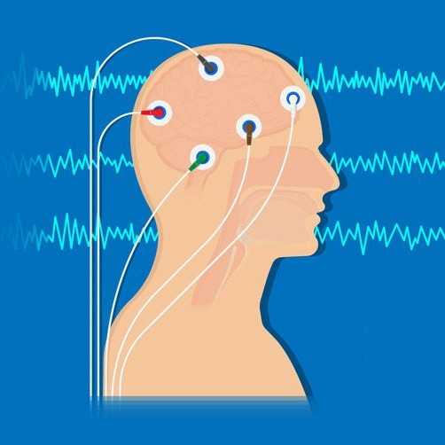 Neurofeedback